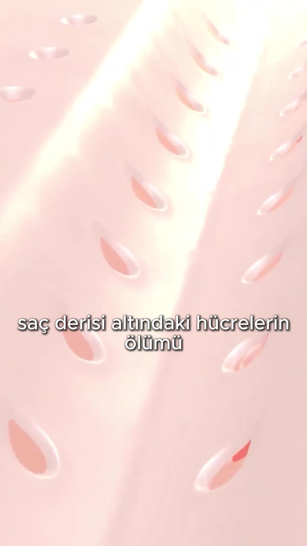Saç Mezoterapi